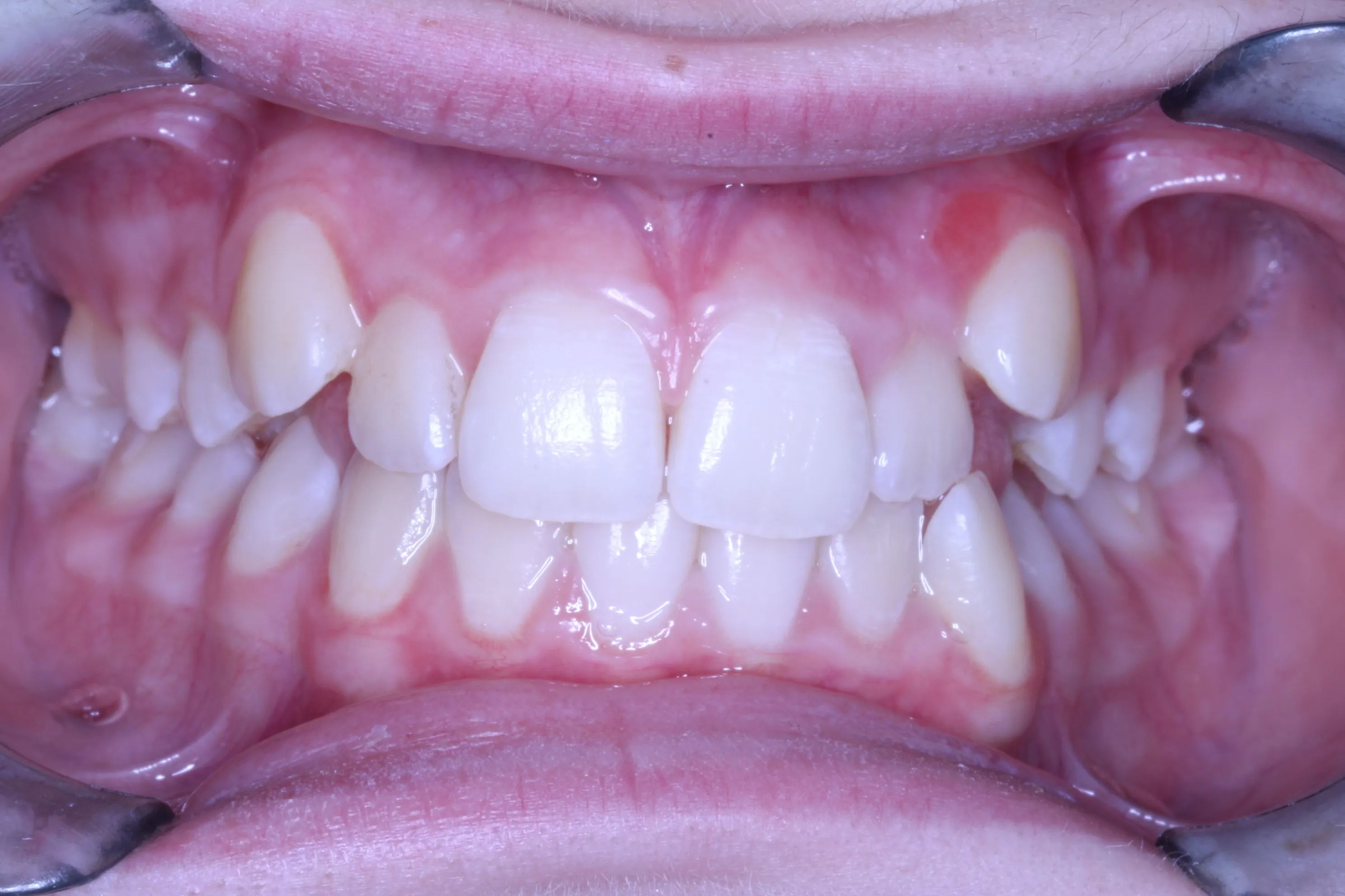 smile-gallery gallery